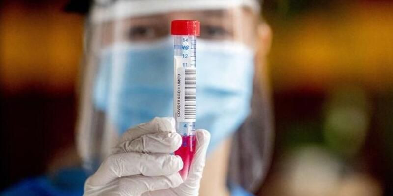 Koronavirüste yeni semptom daha ortaya çıktı: Hıçkırık - Resim: 2