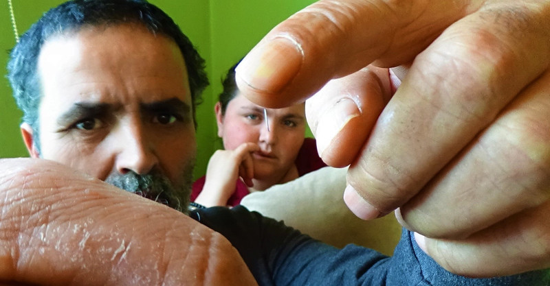 Genç kızı duyan herkes  'öyle bir şey olur mu' diyor - Resim: 1