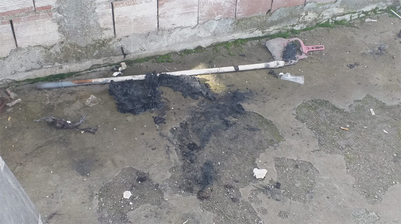 15 yaşındaki Ömer Demir feci şekilde yandı - Resim: 4