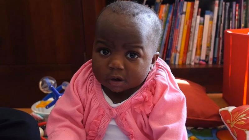 4 bacak ve 2 omurgayla dünyaya gelmişti! İnanılmaz bebek - Resim: 1