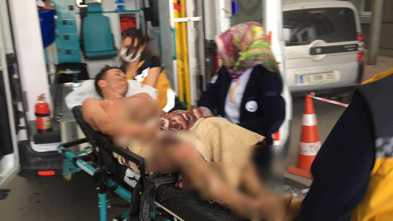 15 yaşındaki Ömer Demir feci şekilde yandı - Resim: 1