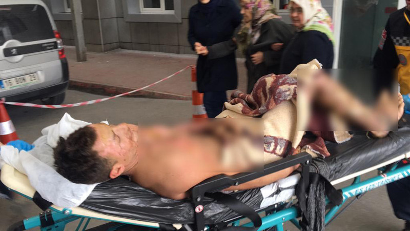 15 yaşındaki Ömer Demir feci şekilde yandı - Resim: 2