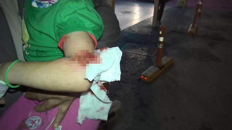 Esenyurt'ta 2 pitbull köpeği kız çocuğuna saldırdı mahalleli çığlıklara koştu - Resim: 1