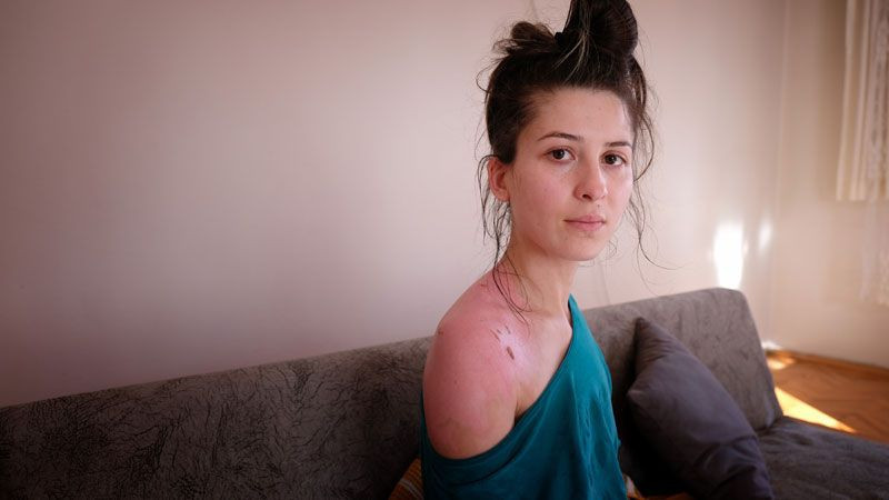 Eşinin sıcak suyla haşladığı Rukiye 1,5 yaşındaki kızının kendisine söylediği sözlerle sarsıldı - Resim: 3