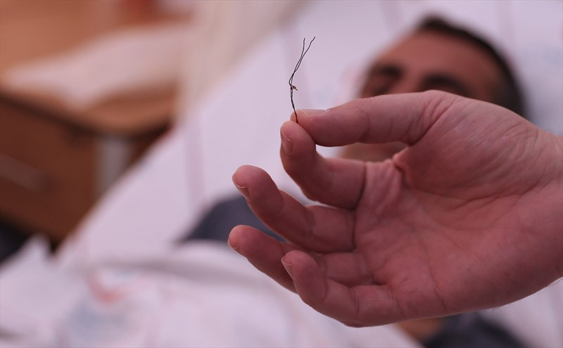 Doktor bile şok oldu bağırsaktan çıkana bakın - Resim: 4