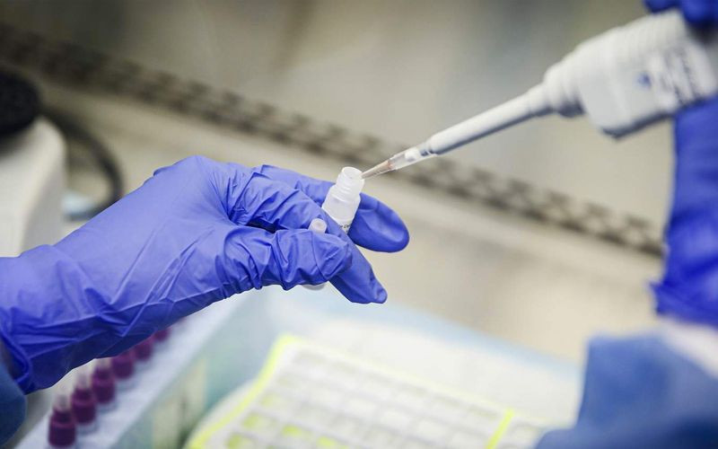 Türkiye'de koronavirüs sayısı kaç oldu? Sağlık Bakanı Fahrettin Koca son durumu açıkladı - Resim: 2