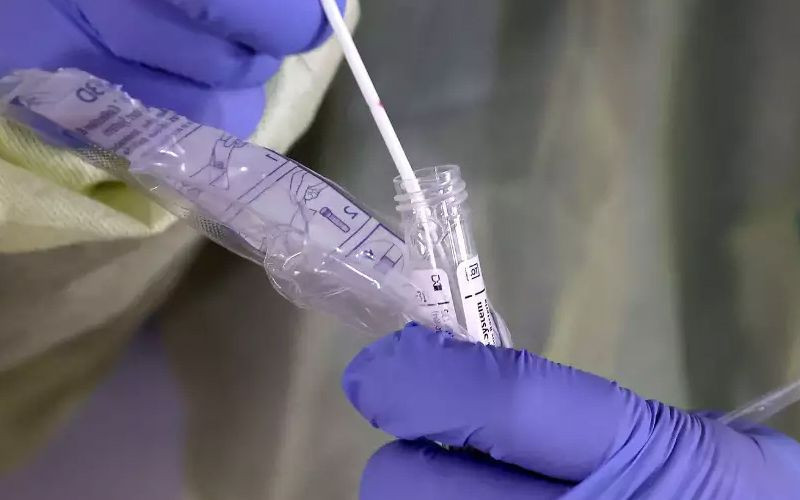 Türkiye'de coronavirüs sayısı kaç oldu? Kahvehaneden hastaneye gitti virüs çıktı - Resim: 4