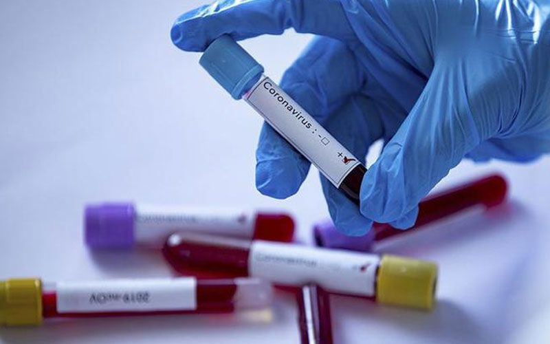 Dünya genelinde yeni tip koronavirüs vaka sayısı 19 milyonu aştı - Resim: 2