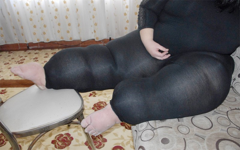 Gamze bir daha asla evden dışarı çıkamayabilir - Resim: 3