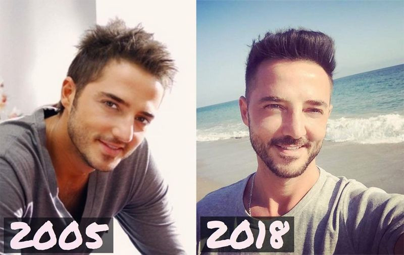 Gökhan Özen'in son hali sosyal medyayı salladı - Resim: 4