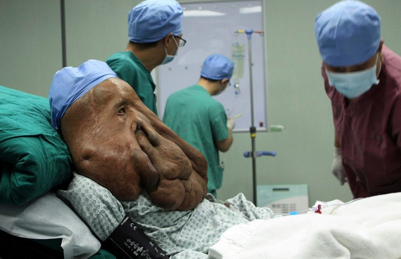 Görüntüsü herkesi ürkütüyor! Fil adamın yaşadıkların bakın - Resim: 4