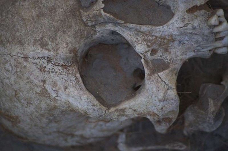 800 yıl önce ölmüştü... Ölüm nedeni 2016'da anlaşıldı! - Resim: 4