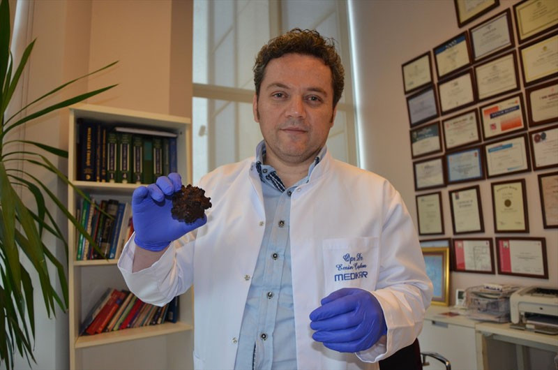 Doktor da şaşkına döndü böylesini ilk kez gördü - Resim: 2