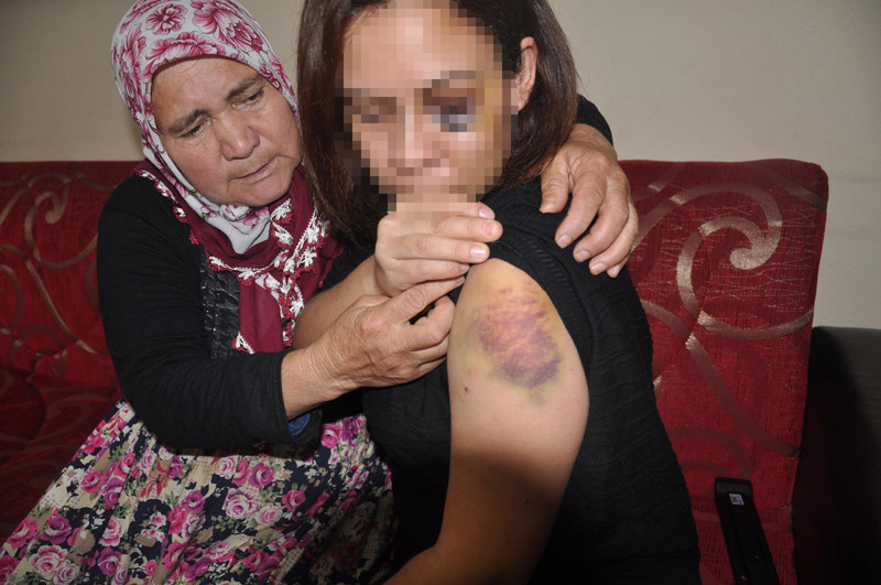 Kocasının feci şekilde dövdüğü kadın her şeyi bir bir anlattı - Resim: 2