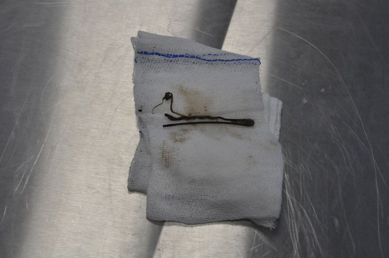 Denizli'de kendinin karnından tel toka çıktı herkes şaşkına döndü - Resim: 1