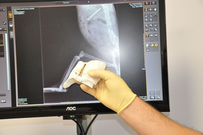 Denizli'de kendinin karnından tel toka çıktı herkes şaşkına döndü - Resim: 3