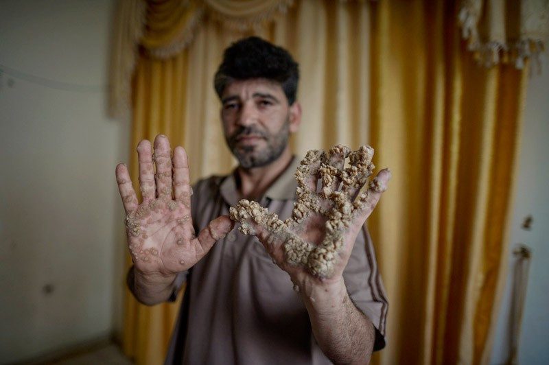 Gazze'li ağaç adamın çığlığı - Resim: 1