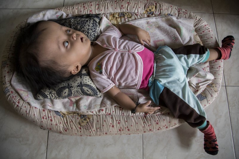 Kafası her gün daha da büyüyor! Tedavi edilmezse... - Resim: 1