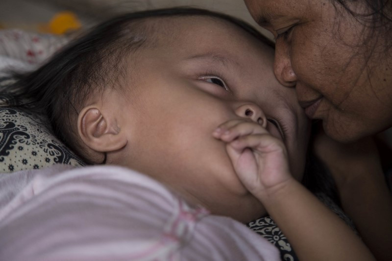 Kafası her gün daha da büyüyor! Tedavi edilmezse... - Resim: 2