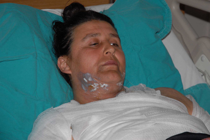 Komşusunu kaynar suyla haşladı gerekçe bakın ne! - Resim: 1