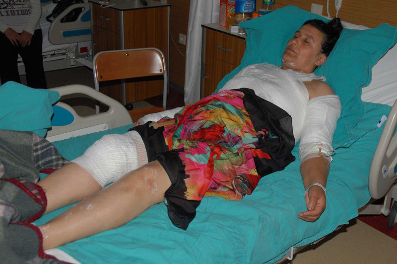 Komşusunu kaynar suyla haşladı gerekçe bakın ne! - Resim: 2