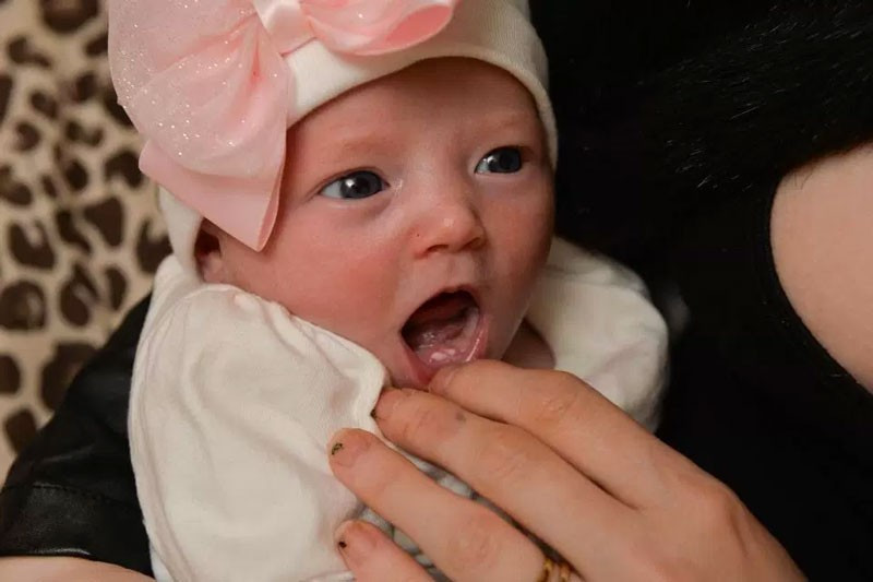 Ağzında dişleriyle doğan bebek herkesi şoke etti! - Resim: 3