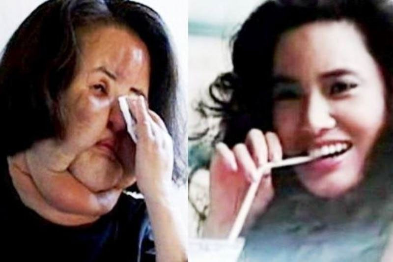 Kaplana benzemek için sayısız operasyon geçirdi inanılmaz! - Resim: 1