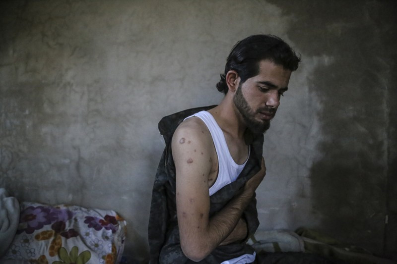 83 şarapnel parçasıyla yaşayan Türkmen komutan konuştu - Resim: 3