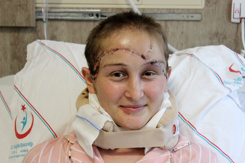 Baş derisi kopan Binnaz'ın anlattıkları dehşete düşürdü - Resim: 3