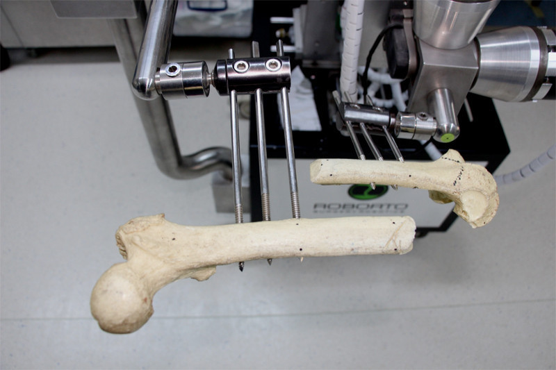 Türk doktor yaptı artık açık ameliyata gerek kalmayacak - Resim: 4