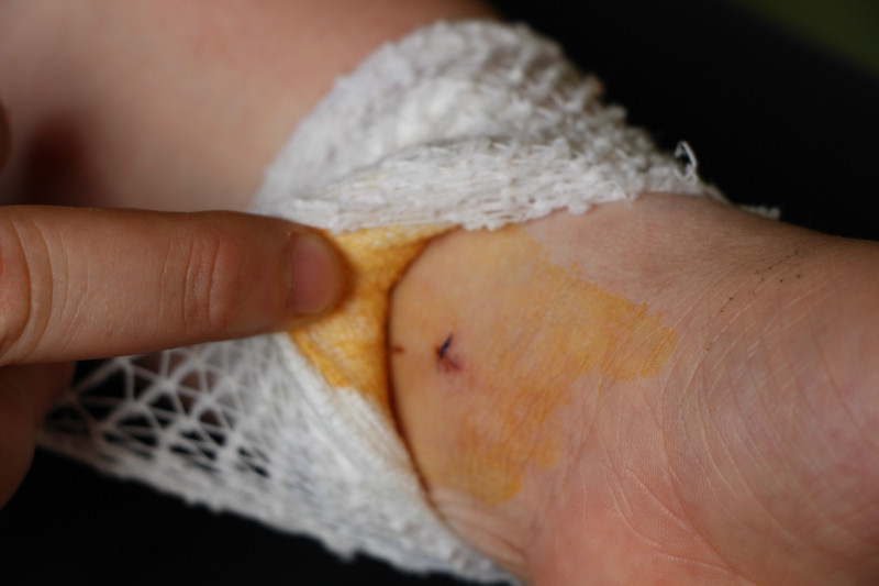 Genç kızı duyan herkes  'öyle bir şey olur mu' diyor - Resim: 4