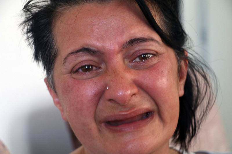 Bembeyaz diş istedi 32 dişinden oldu - Resim: 4