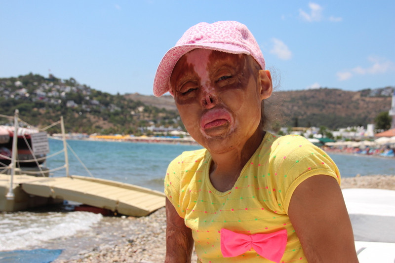 Yüzünü gören çocuklar köşe buçak kaçıyor - Resim: 1