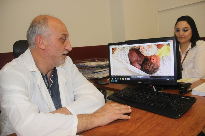 Hatay’da iki kafalı bebek dünyaya geldi - Resim: 2