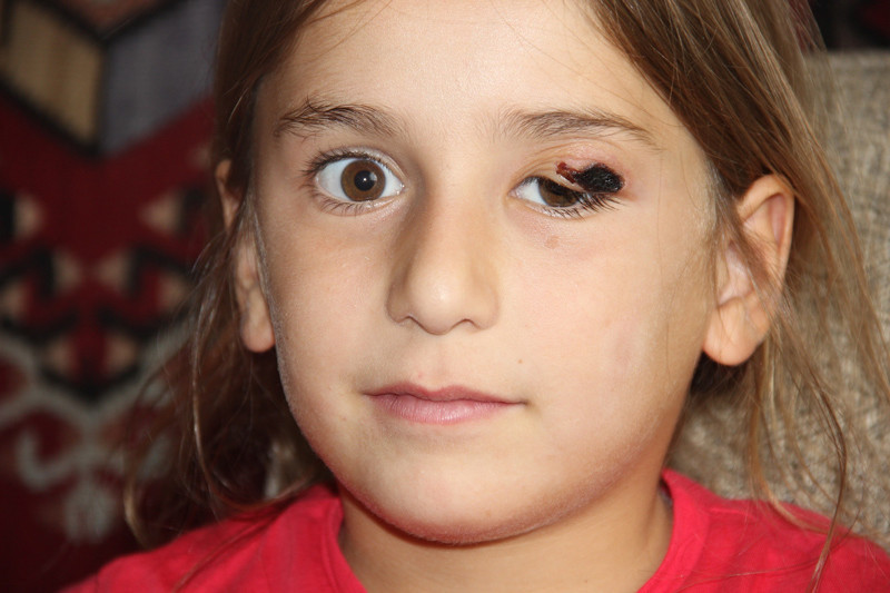 Şehir alarmda dokunanda bu yaralar çıktı karantina başladı - Resim: 1