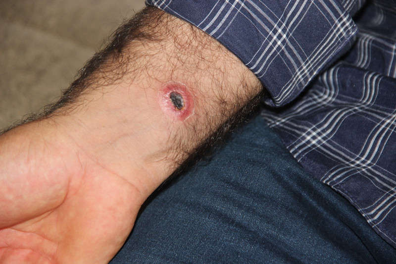 Şehir alarmda dokunanda bu yaralar çıktı karantina başladı - Resim: 2