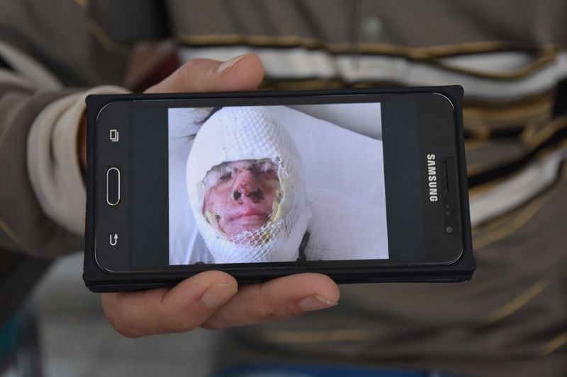 Berfin Özek tanınmaz hale geldi babası ilk kez konuştu - Resim: 4