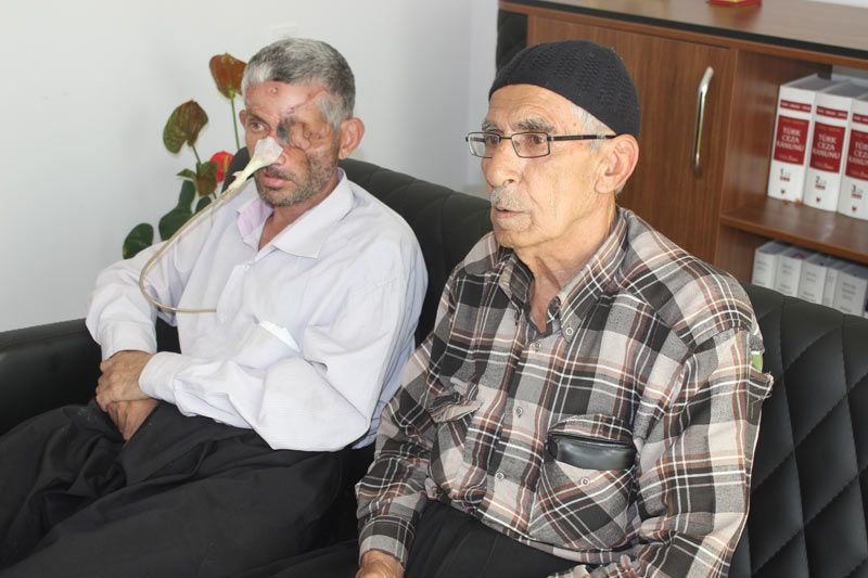 Ağrıyan dişini çektirdi yüzünün yarısı çöktü bir gözü kayboldu - Resim: 3