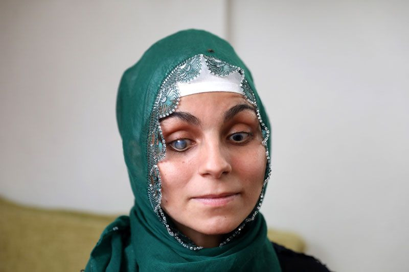 21 yaşındaki Ayşe Acar kendini ilk kez aynada gördü - Resim: 2