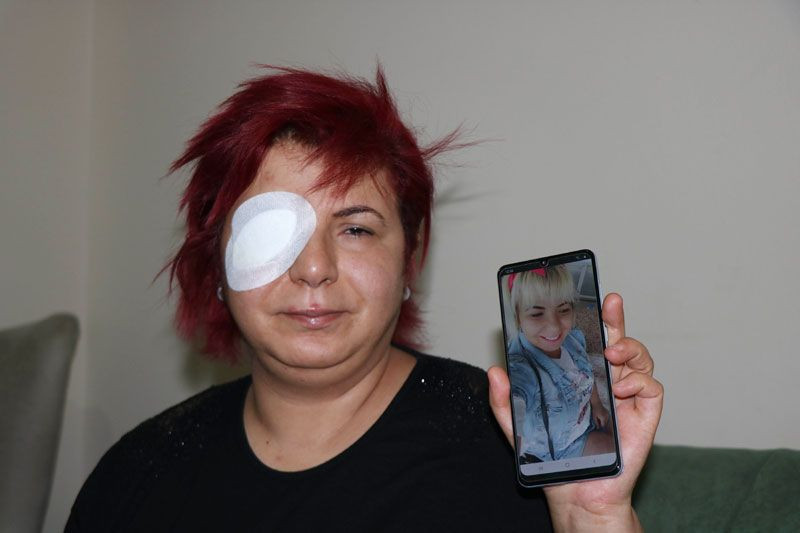 Samsun'da genç kız tanınmaz hale geldi önce hayatı sonra gözleri karardı - Resim: 1