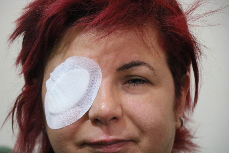 Samsun'da genç kız tanınmaz hale geldi önce hayatı sonra gözleri karardı - Resim: 4