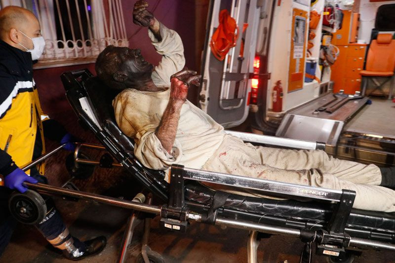 Adana'da yangında korkunç görüntü komşuları son anda çıkardı tanınmayacak hale geldi - Resim: 3