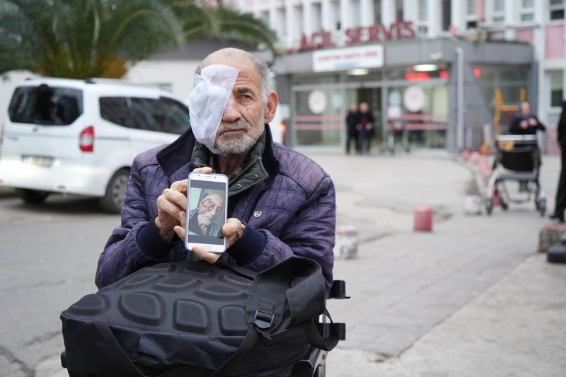 Yüzü eriyor yarası gittikçe büyüyor yaşlı adam hastane koridorlarında yatıyor - Resim: 1