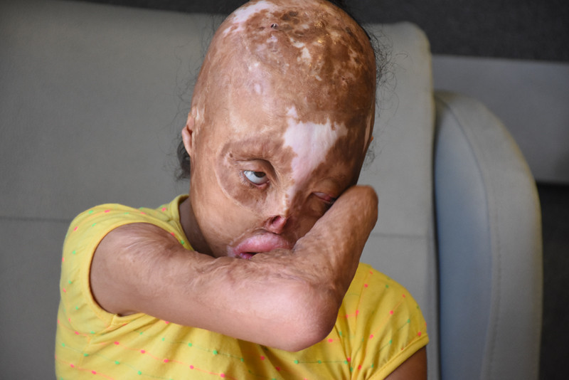 Yüzünü gören çocuklar köşe buçak kaçıyor - Resim: 3