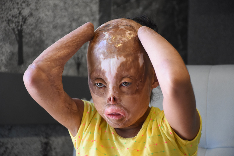 Yüzünü gören çocuklar köşe buçak kaçıyor - Resim: 4