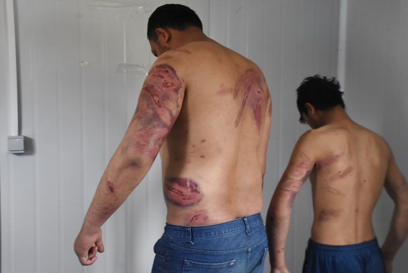 Yunan polisi Pakistanlı göçmenleri dövüp Türkiye'ye gönderdi - Resim: 2