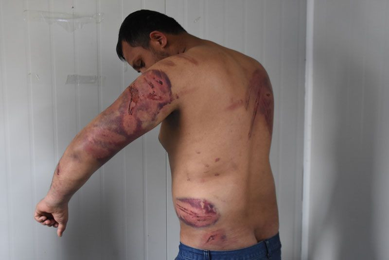 Yunan polisi Pakistanlı göçmenleri dövüp Türkiye'ye gönderdi - Resim: 3