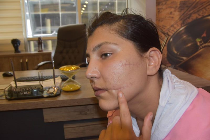 Eşinin 104 yerinden bıçakladığı Aysel isyan etti: Pencereye dahi çıkamıyorum - Resim: 2