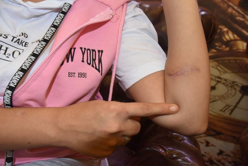 Eşinin 104 yerinden bıçakladığı Aysel isyan etti: Pencereye dahi çıkamıyorum - Resim: 3