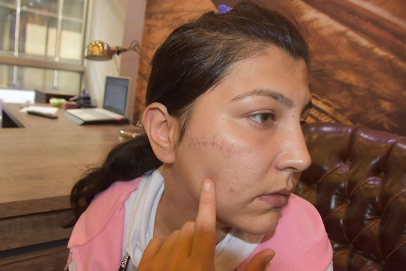 Eşinin 104 yerinden bıçakladığı Aysel isyan etti: Pencereye dahi çıkamıyorum - Resim: 4